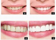 Özel Logo Kişisel Bakım Ürünleri Ev Diş Beyazlatma İçin Diş Beyazlatma Sistemi